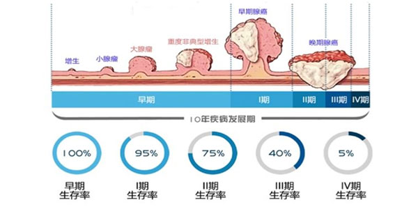 大肠癌分型图片